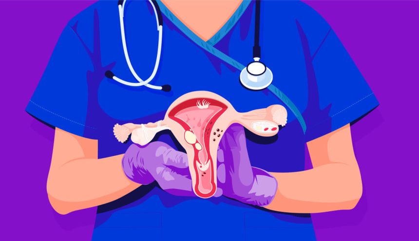 7 simptomat e ‘kamofluara’ të kancerit të mitrës që shumica e grave i injorojnë